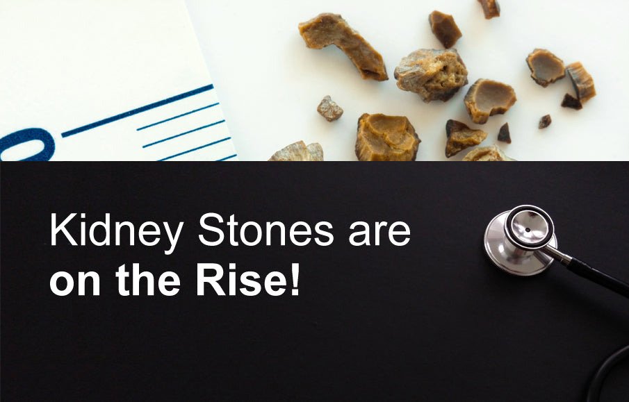 Kidney Stones Are on the Rise!